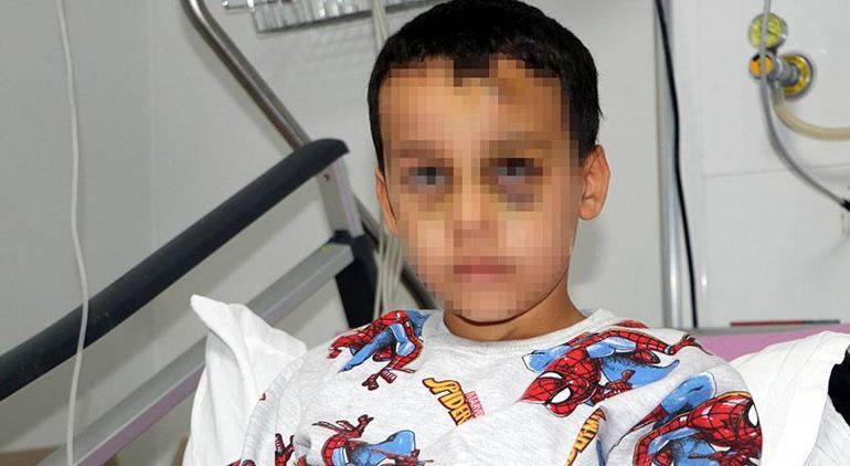 Çocuk yuvasında bakıcı skandalı! 8 yaşındaki çocuk yoğun bakıma kaldırıldı